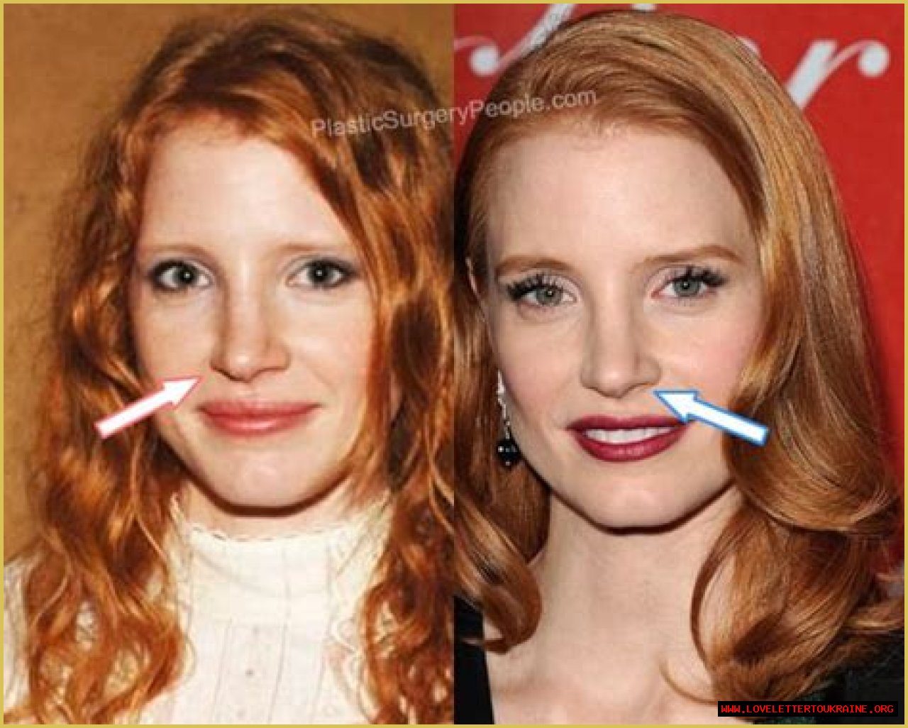 Jessica Chastain | Nose Surgery