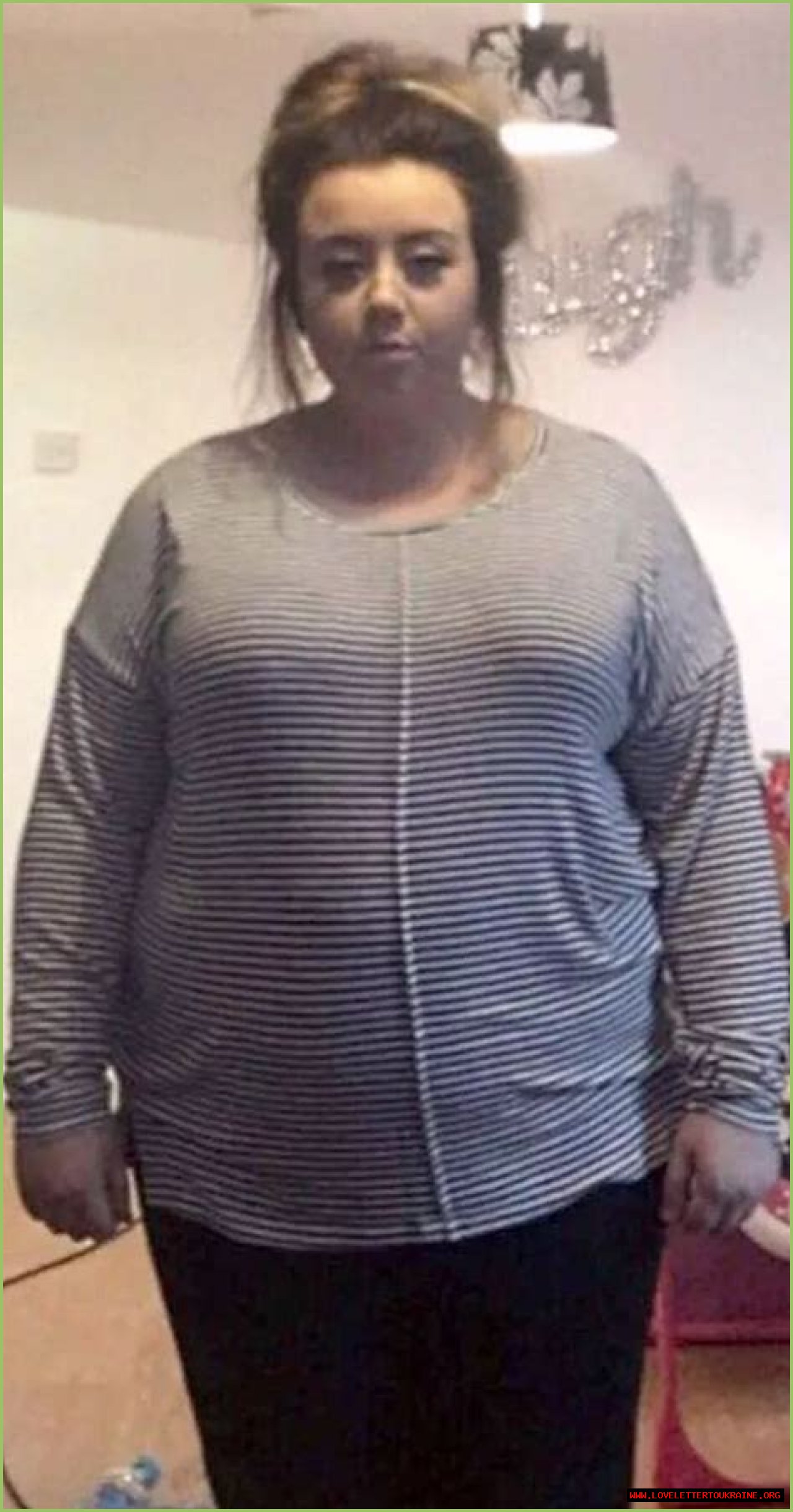 ‘So much fat!’ – the cruel autopsy of a 17-stone woman on the BBC